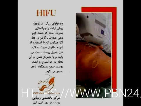 بهترین دکتر هایفو نی نی سایت