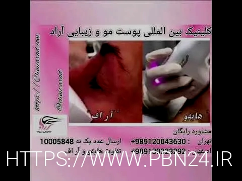 آر اف بهتر است یا هایفو